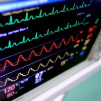 errores interpretar electro